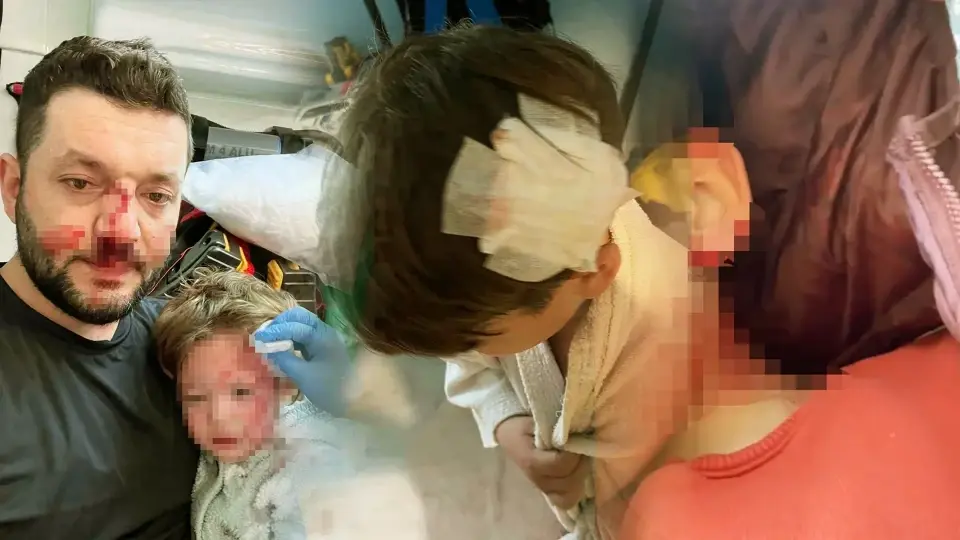 Kucağındaki Bebeğiyle Darbedilen Baba'nın Oğlunu Taşla Yaraladılar