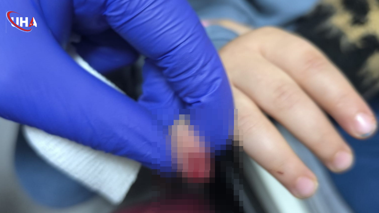 mardinde-parmagi-kopan-cocuk