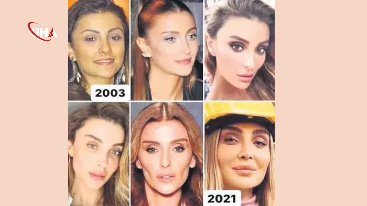 ozge-ulusoy-estetik-itiraf-magazin