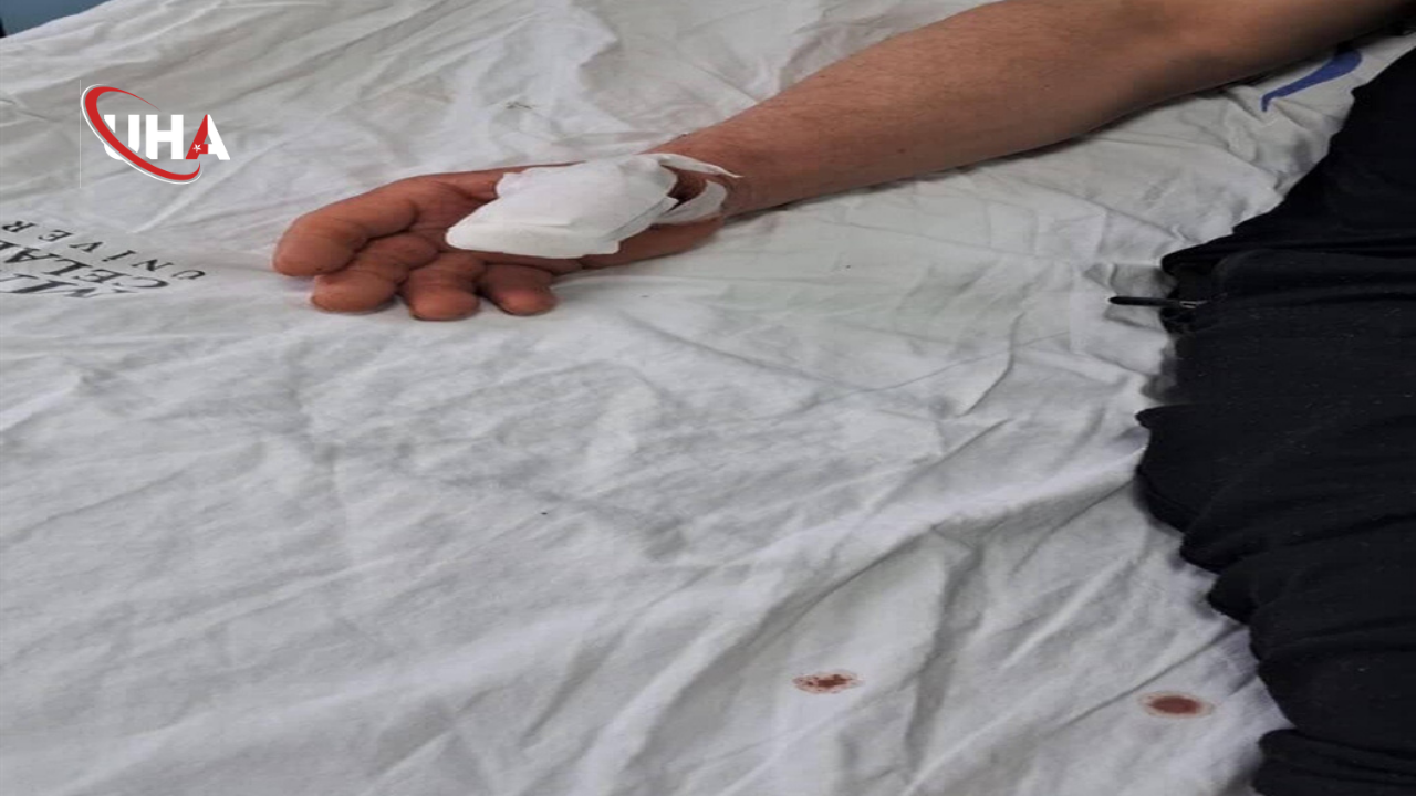 manisa-kopek-saldirisi