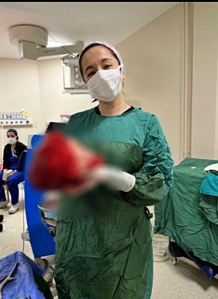 Gögsünden Kitle Çıkarıldı 2